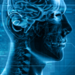 Radiology Skull Image