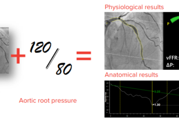 Caas vFFR to Compete with Traditional FFR